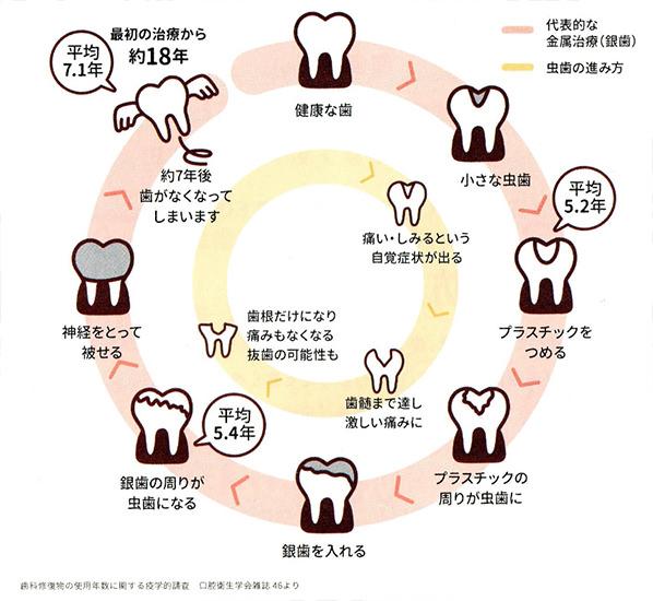 治療後の歯の寿命を説明した図