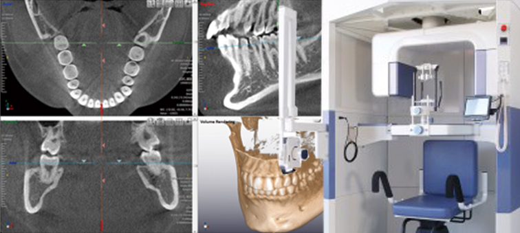 精密な治療を可能にする設備のイメージ