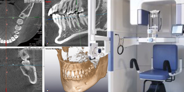 歯科用CTスキャン