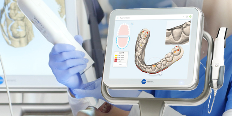 iTeroエレメント