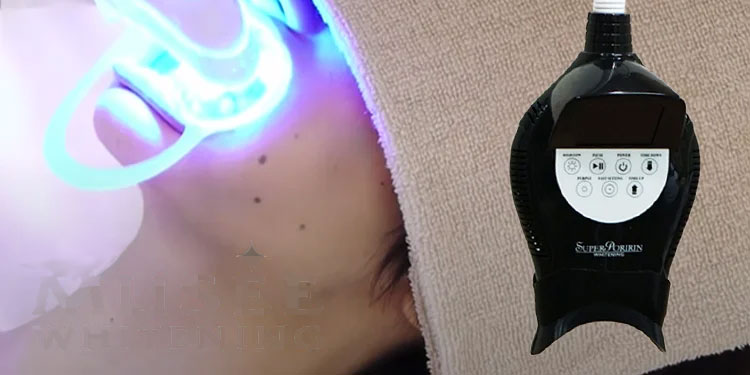 ホワイトニングシステム